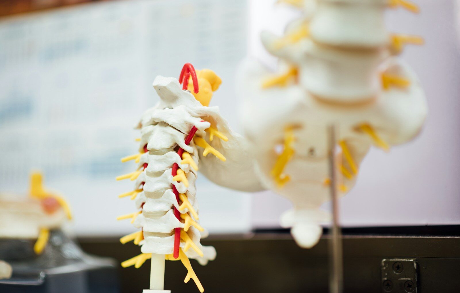 white and yellow ice cream with cone